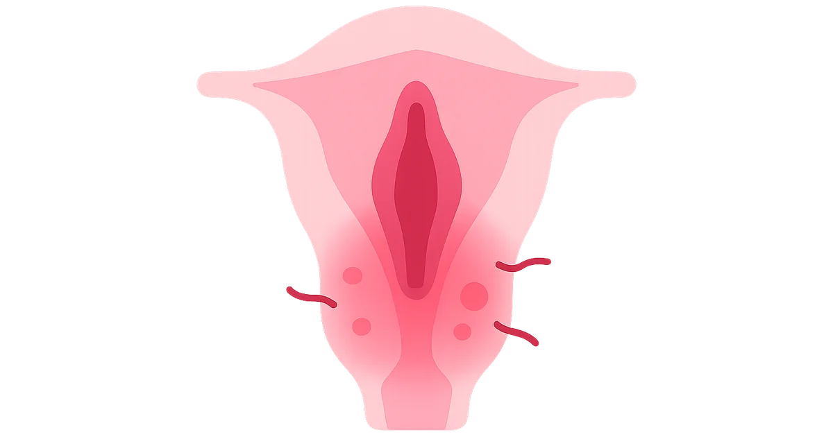 Vulvovaginitis — NEET-PG Notes | Oncourse
