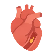 Acute coronary syndromes