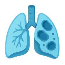 COPD diagnosis and exacerbations