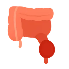 Appendicitis