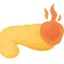 Acute pancreatitis
