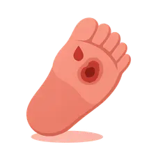 Diabetes complications and screening