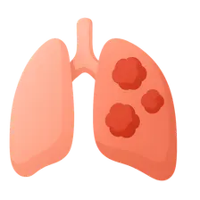 Tuberculosis