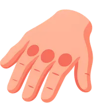 Rheumatoid arthritis