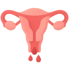 Abnormal uterine bleeding