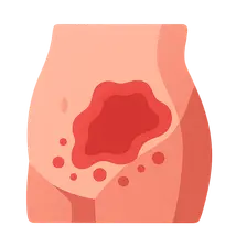 Acute abdomen