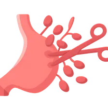 Lymphadenectomy