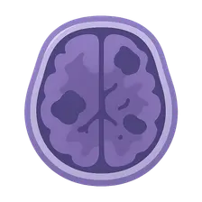 CNS Infections