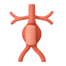 Abdominal aortic aneurysm repair