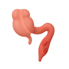Appendicitis