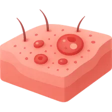 Viral Infections in Immunocompromised Hosts