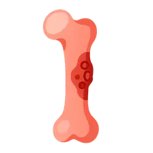 Skeletal Infections