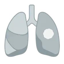Radiographic Signs in Chest Imaging