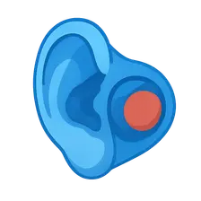 Barotrauma of the Ear