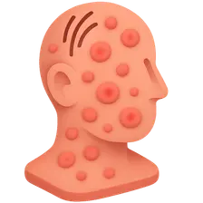 Complications of Immunotherapy
