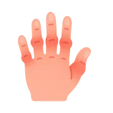 Rheumatoid arthritis