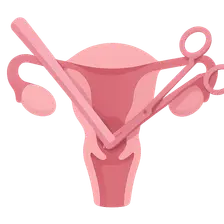 Surgical Management in Urogynecology