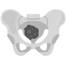 Clinical correlations in pelvis/perineum