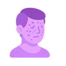 Systemic lupus erythematosus