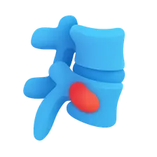 Spondyloarthropathies