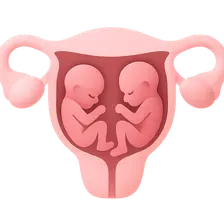 Management of Multiple Gestation