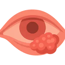 Malignant Tumors of Conjunctiva