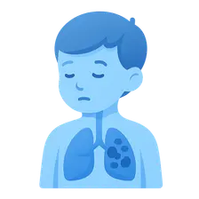 Tuberculosis in Children