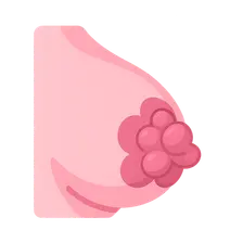 Benign Breast Diseases