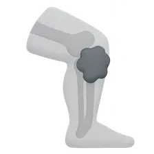 Clinical correlations of lower limb