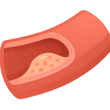 Atherosclerosis