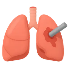 Chest Trauma Management