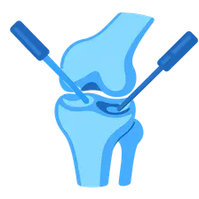 Therapeutic Arthroscopic Procedures