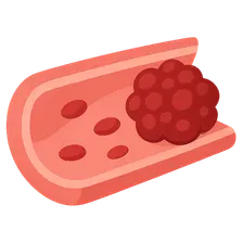 Biochemistry of Hemostasis