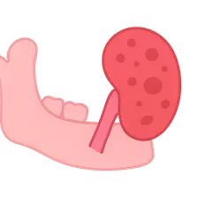 Sialadenitis