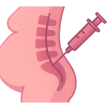 Regional Anesthesia in Obstetrics