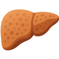 Alcoholic liver disease