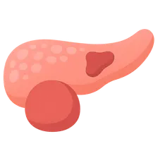 Local complications of acute pancreatitis