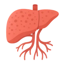 Cirrhosis and Portal Hypertension