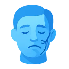 Facial Nerve Paralysis