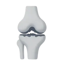 Osteoarthritis of Knee