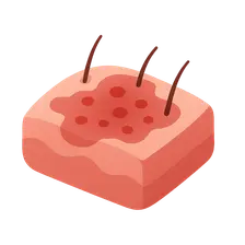 Inflammatory Dermatoses