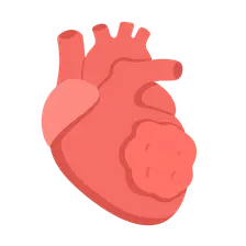 Cardiac Tumors
