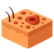 Cutaneous Tuberculosis