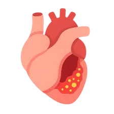 Endocarditis