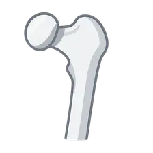 Slipped Capital Femoral Epiphysis