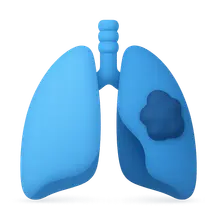 Altered compliance in disease states