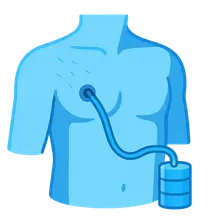 Chest tube insertion and management