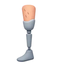 Lower Limb Prosthetics