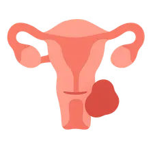 Surgical Complications in Obstetrics