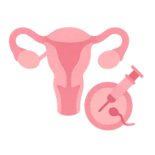 Assisted Reproductive Technologies